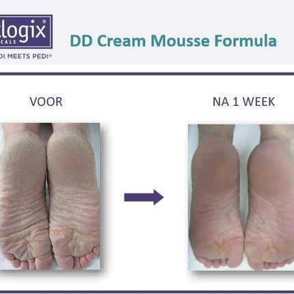 Footlogix DD Cream Mousse voor Hydratatie Nr. 1