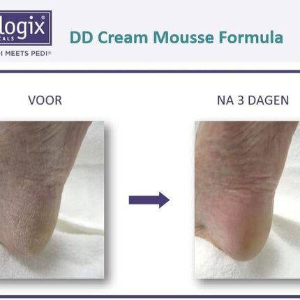 Footlogix DD Cream Mousse voor Hydratatie Nr. 1